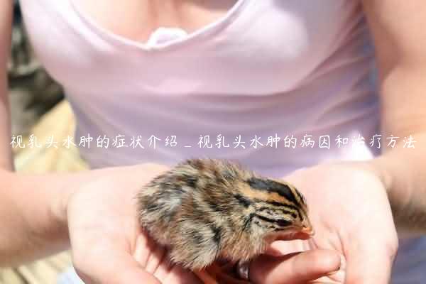 视乳头水肿的症状介绍_视乳头水肿的病因和治疗方法