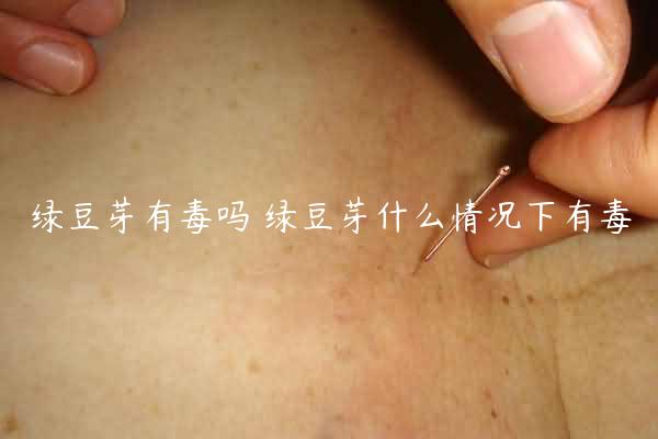 绿豆芽有毒吗 绿豆芽什么情况下有毒