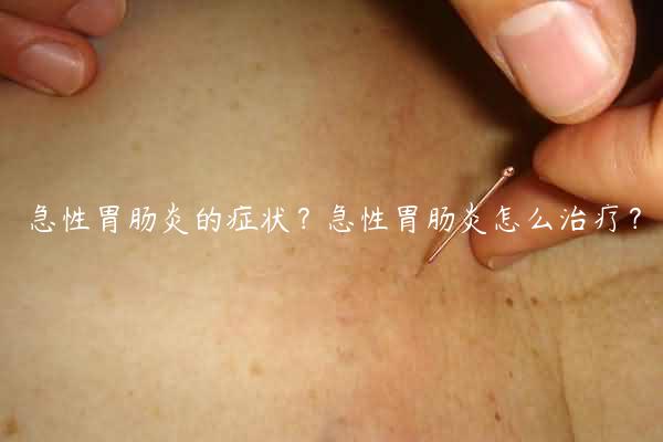 急性胃肠炎的症状？急性胃肠炎怎么治疗？